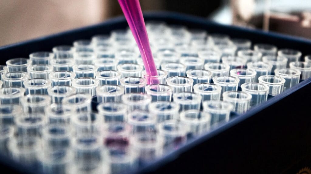 pcr testiranje na koronavirus (covid-19) - 2022.