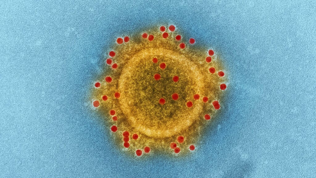 koronavirus | coronavirus | sars-cov-2 | 2022.
