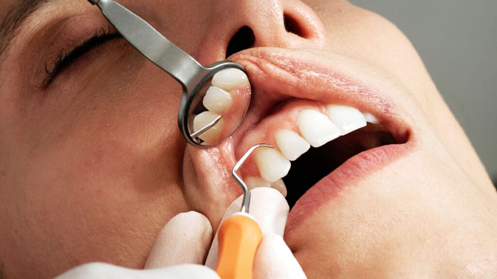 zubni implantati | videntis dentalni centar zagreb | 2022.