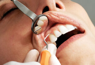 zubni implantati | videntis dentalni centar zagreb | 2022.