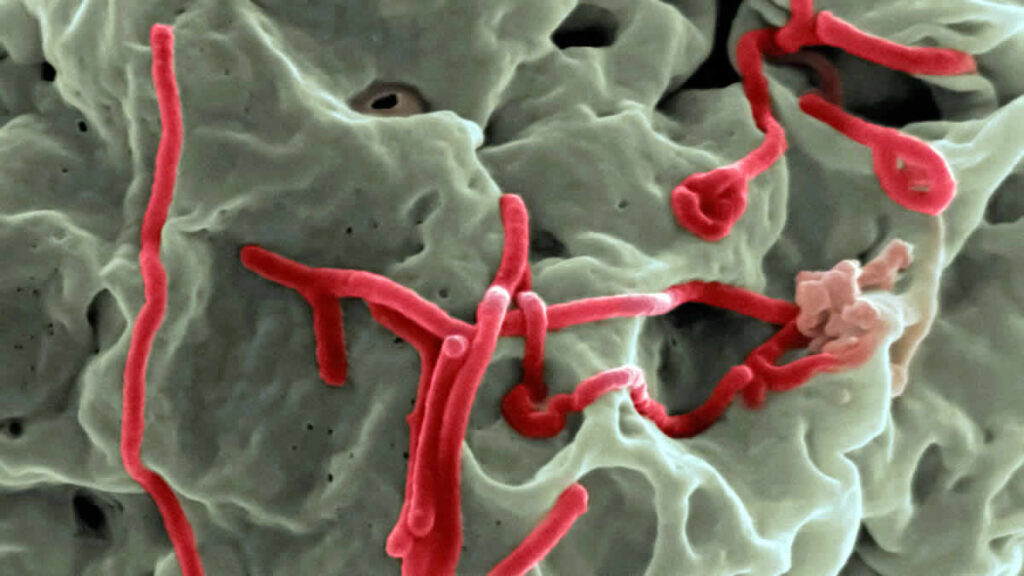 world news | ebola virus | 2024.
