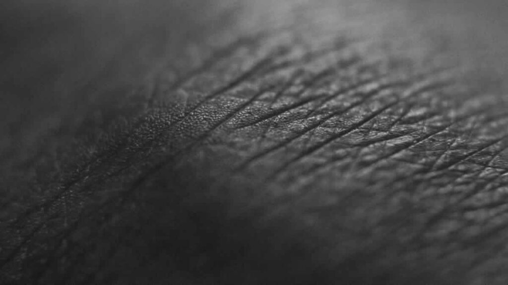 psorijaza | psoriasis | 2024.