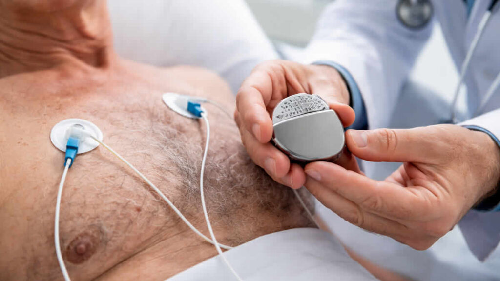 pacemaker | 2026.